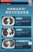 调查｜原装进口保健品声称“可治疗肺结节，改善肺癌”：国内代工厂提供一条龙进口服务，一瓶成本可低至10元